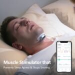 Smart Anti Snoring Device Electronic Muscle Stimulator Pro - Image 6